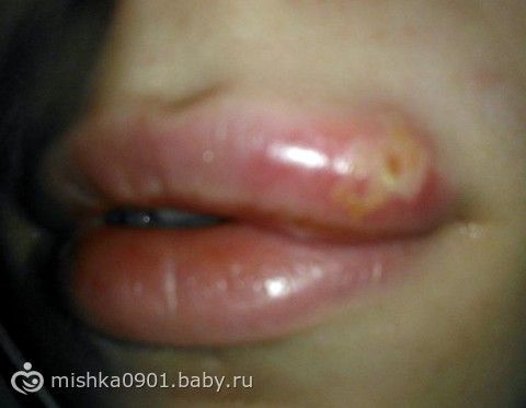 Как сделать классический обрезной маникюр дома Девочкам в возрасте 3 лет рекомендуют делать прическу каре