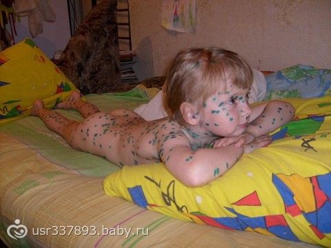 Курантил для беременных для чего назначают 15