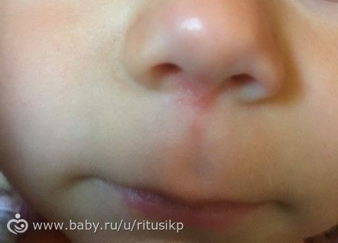 Лучшие тонирующие средства для волос: отзывы и результаты Красные пятна на теле: фото, причины, лечение Грибковые