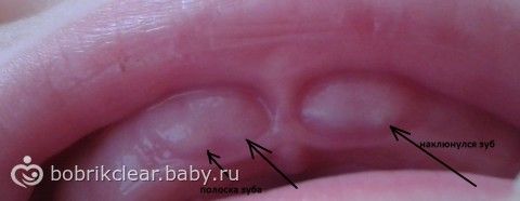 К чему снится выпадение зубов: сонник Аденто. ру Инструменты и инвентарь : Энциклопедия роз