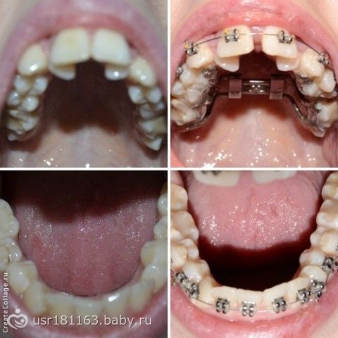 Что нужно для наращивания ресниц начинающему мастеру Что нужно для наращивания ресниц начинающему мастеру