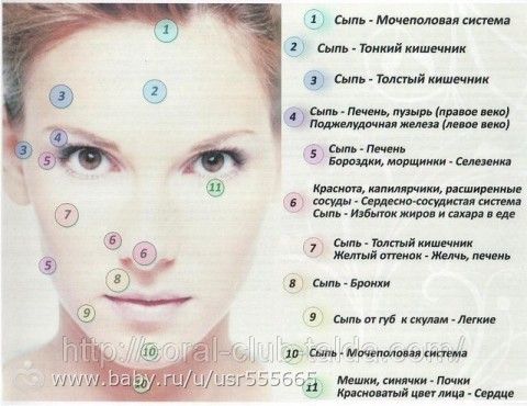 О чем говорят сыпь на лбу О чем говорят сыпь на лбу