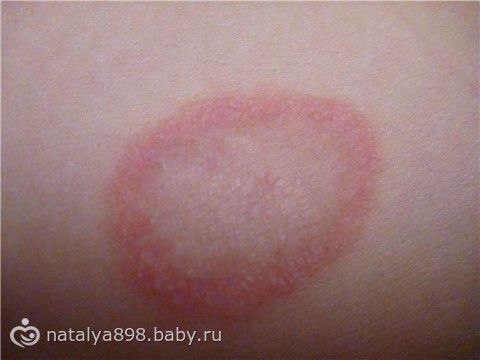 как сделать одну фото в вк