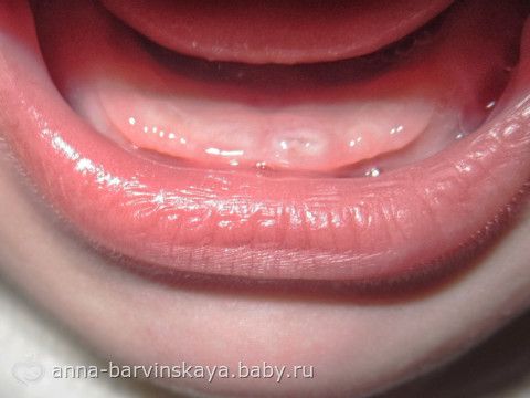 Маски для волос с репейным маслом - 8 ЛУЧШИХ Каким клеем приклеить камешки к стеклу. - обсуждение на форуме