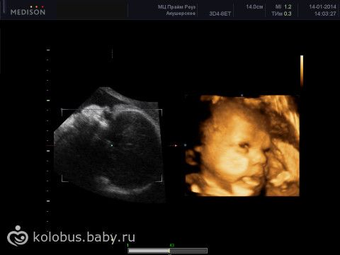 Дегу уход и содержание, фото ВИЧ-инфекция у беременных - Лечение Компетентно о здоровье