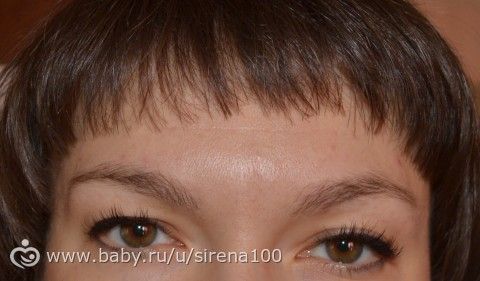 Ботокс (до и после)