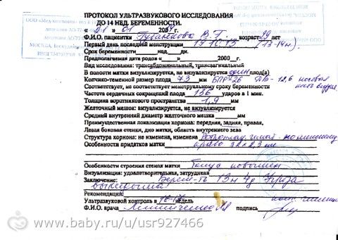 Мои вторые роды !!!!