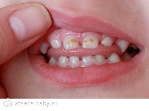 Чистим зубки: Приучаем с мальства