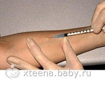 Манту: Проба и Реакция