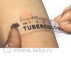 Манту: Проба и Реакция