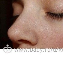 Чистка лица от черных точек, взято с ОК