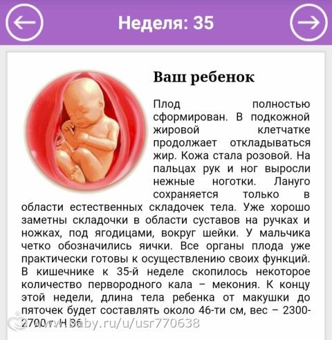 34 недели - время, постой!