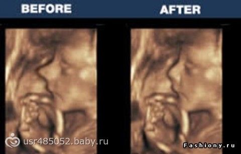 дом малютки в иваново фото детей на усыновление