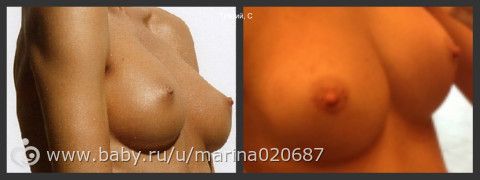 Нескромный вопрос про грудь!