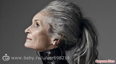 8 женщин,чьи дефекты не помешали им стать успешными фотомоделями