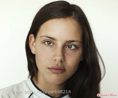 8 женщин,чьи дефекты не помешали им стать успешными фотомоделями