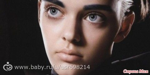 8 женщин,чьи дефекты не помешали им стать успешными фотомоделями
