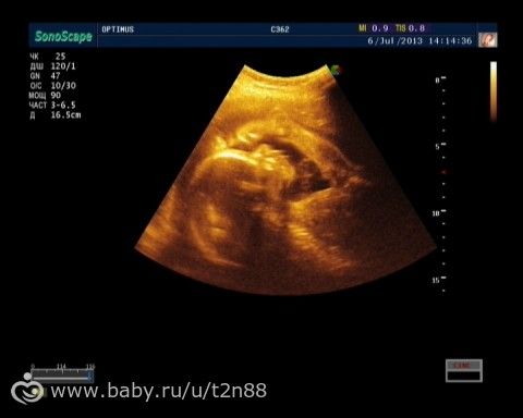 Фото с ЗD-УЗИ сына и просто фото с УЗИ