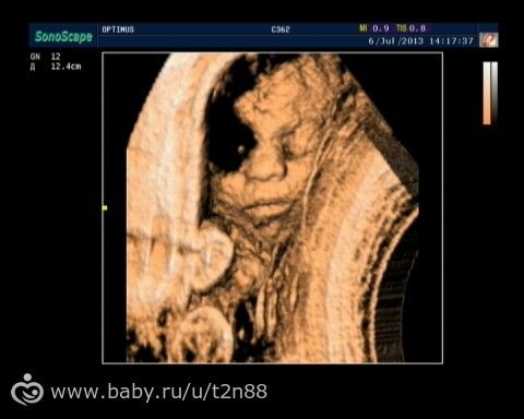 Фото с ЗD-УЗИ сына и просто фото с УЗИ