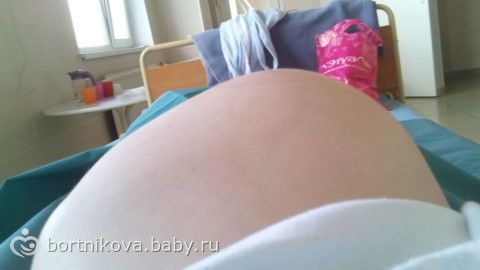 История моих вторых родов (ДО) Часть 1