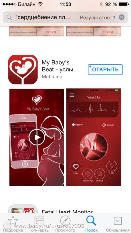 Звук сердцебиения ребенка скачать бесплатно