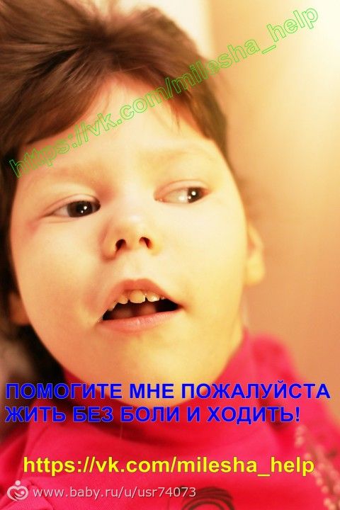 Белозерова Миленочка, 4 года. ДЦП. ОТКРЫТ СБОР на 2-ой курс реабилитации в мц ЭЛЬМАР