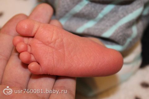 Мои роды. Стимуляция. Кесарево.
